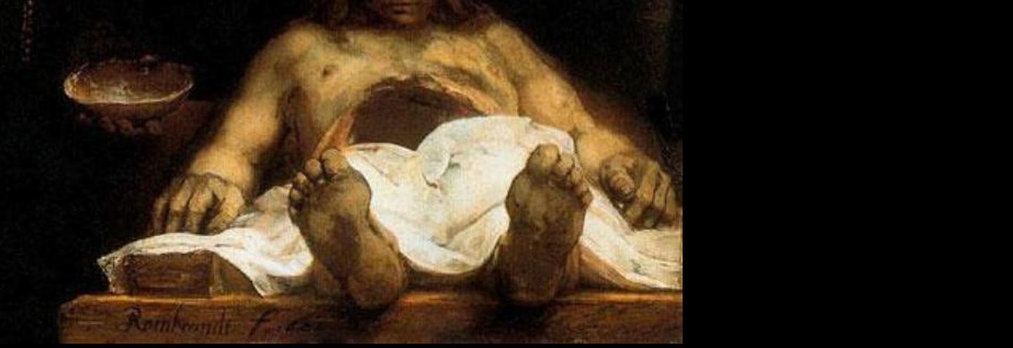 Sample: Рембрандт ван Рейн «Урок анатомии доктора Деймана»